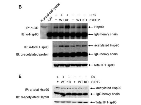 Immunoprecipitation using HSP90 K294ac